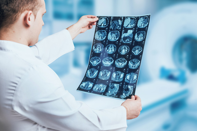 medical scans