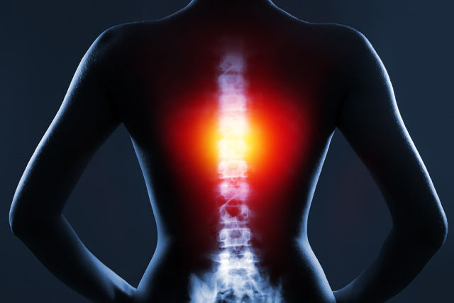 spine x-ray