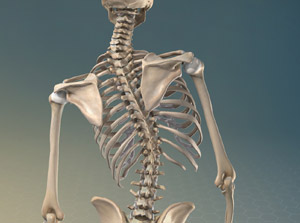 scoliosis_300